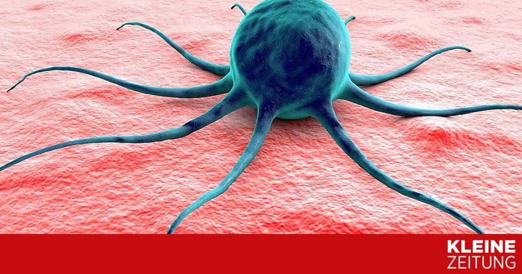 eiweissstoffe-“g3bp”-verhindern-krebszellreisen-und-epilepsie