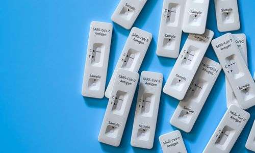 pro-woche:-500.000-testkits-fuer-steirische-unternehmen pro-woche:-500.000-testkits-fuer-steirische-unternehmen