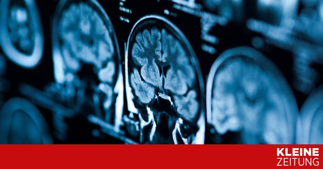 forscher-wollen-mit-ionenpumpen-hirntumore-zielgerichtet-anvisieren forscher-wollen-mit-ionenpumpen-hirntumore-zielgerichtet-anvisieren