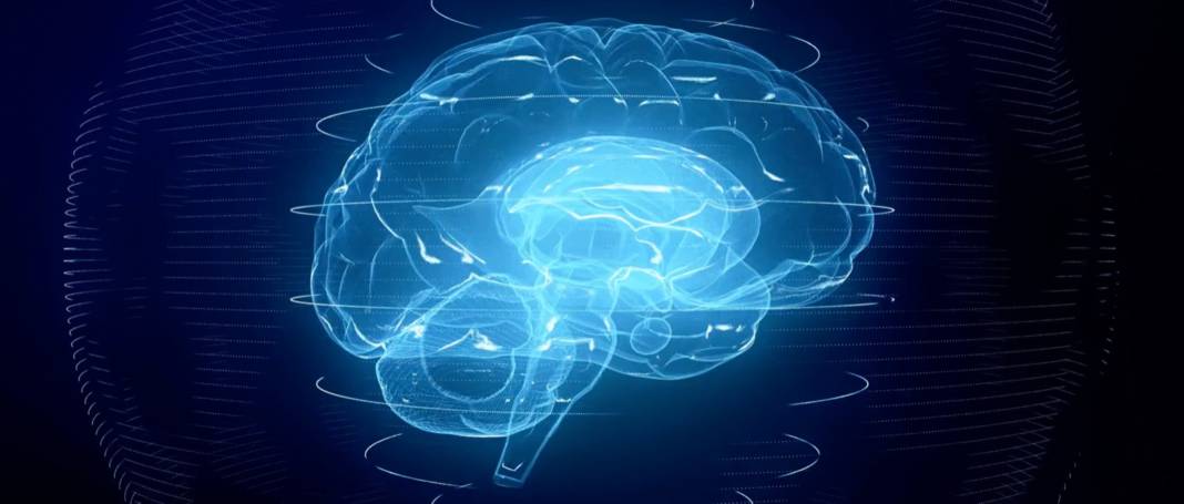 Brain2
