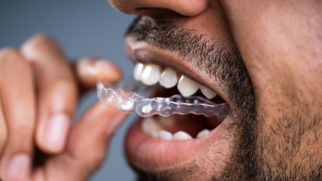 anti-knirsch-hilfe:-aufbissschiene-reinigen:-wirksame-mittel-gegen-ablagerungen anti-knirsch-hilfe:-aufbissschiene-reinigen:-wirksame-mittel-gegen-ablagerungen