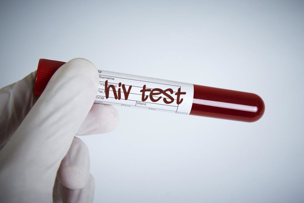 viren-evolution:-aggressivere-hiv-variante-in-holland-entdeckt viren-evolution:-aggressivere-hiv-variante-in-holland-entdeckt