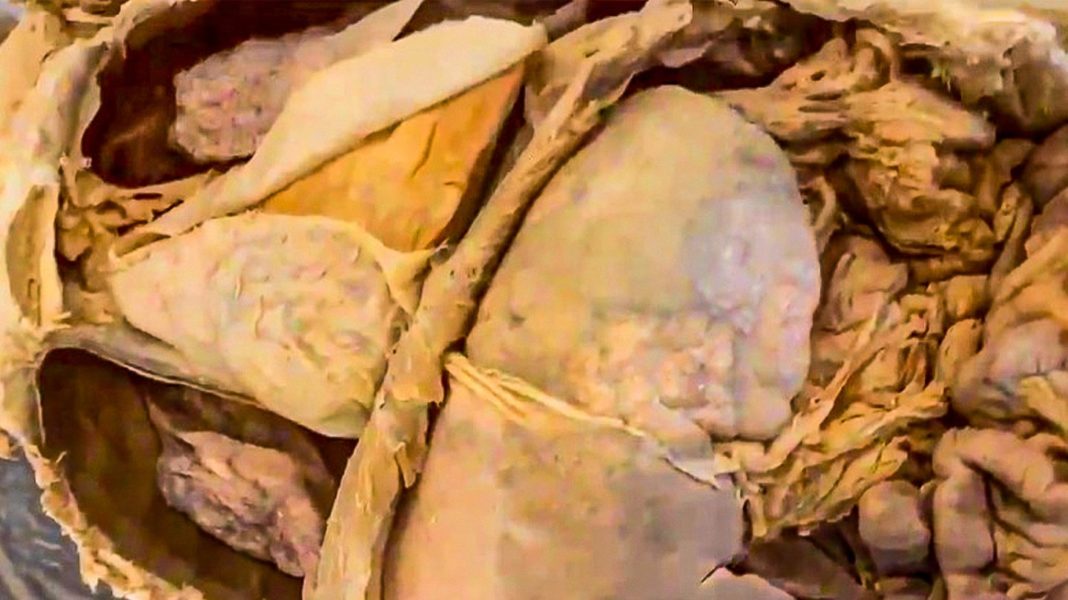 “institute-of-human-anatomy”:-leichenteile-auf-tiktok:-warum-millionen-menschen-einem-kanal-folgen,-der-kadaver-aufnahmen-postet