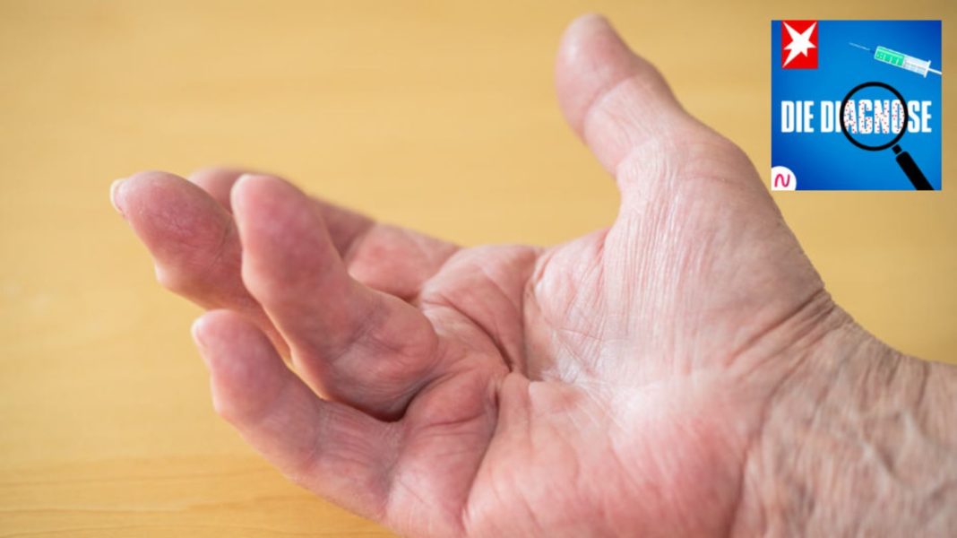 “die-diagnose”:-abstehender-finger-nach-verletzung-–-erbliche-krankheit-entdeckt “die-diagnose”:-abstehender-finger-nach-verletzung-–-erbliche-krankheit-entdeckt
