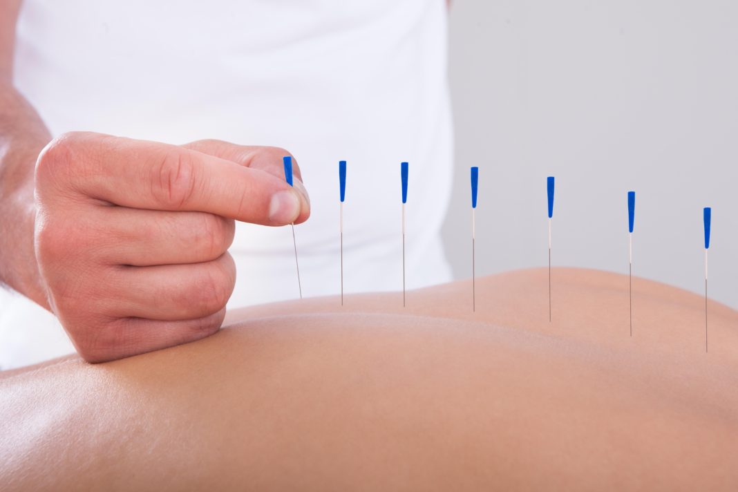 weltgesundheitsorganisation-erforscht-jetzt-alternativmedizin weltgesundheitsorganisation-erforscht-jetzt-alternativmedizin
