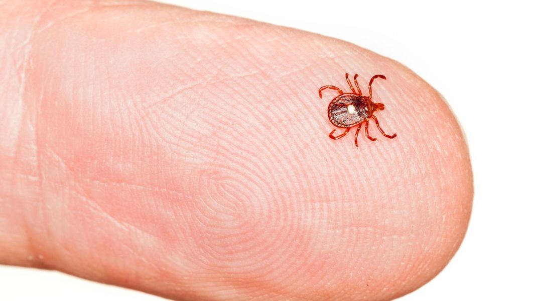 “alpha-gal-syndrom”:-neue-allergie:-wer-von-der-einzelsternzecke-gebissen-wird,-kann-kein-rotes-fleisch-mehr-essen