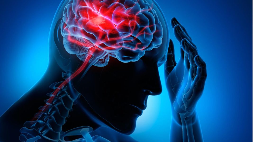 erste-hilfe:-fast-methode:-wie-sie-einen-schlaganfall-schnell-erkennen erste-hilfe:-fast-methode:-wie-sie-einen-schlaganfall-schnell-erkennen