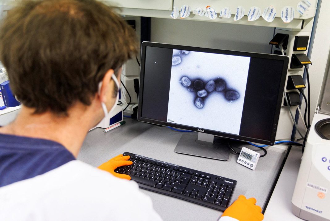 affenpocken:-oesterreichischem-patienten-geht-es-“gut” affenpocken:-oesterreichischem-patienten-geht-es-“gut”