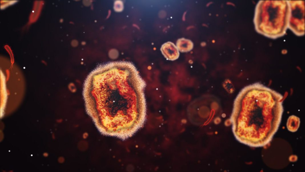 affenpocken:-“verhindern,-dass-sich-das-virus-in-europa-festsetzt” affenpocken:-“verhindern,-dass-sich-das-virus-in-europa-festsetzt”