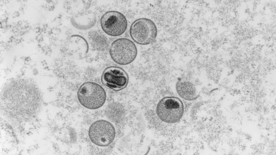 stigmatisierung-vorbeugen:-who-will-namen-der-affenpocken-aendern stigmatisierung-vorbeugen:-who-will-namen-der-affenpocken-aendern