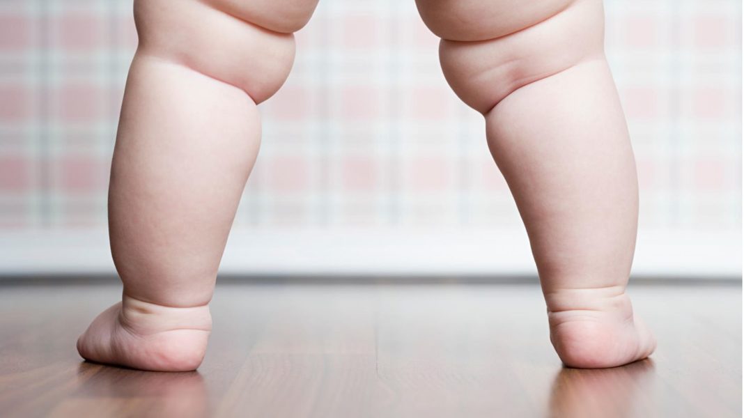 studie-ueber-30-jahre:-uebergewichtige-kinder-haben-wohl-ein-groesseres-risiko-spaeter-an-demenz-zu-erkranken studie-ueber-30-jahre:-uebergewichtige-kinder-haben-wohl-ein-groesseres-risiko-spaeter-an-demenz-zu-erkranken