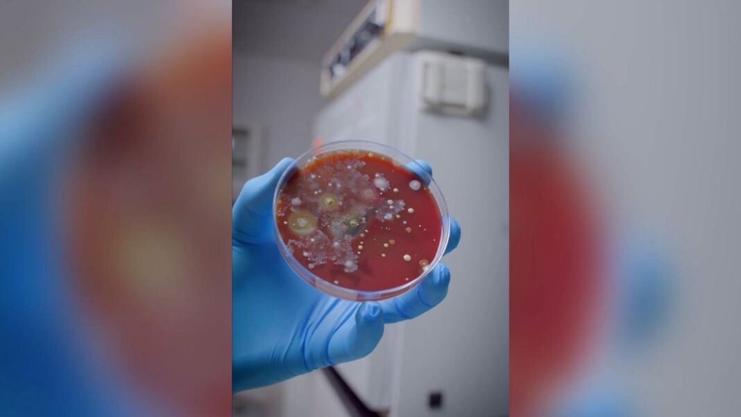 wegen-krankheitserregern:-mediziner-warnt-mit-tiktok-experiment:-in-oeffentlichen-toiletten-bloss-keine-handtrockner-benutzen wegen-krankheitserregern:-mediziner-warnt-mit-tiktok-experiment:-in-oeffentlichen-toiletten-bloss-keine-handtrockner-benutzen