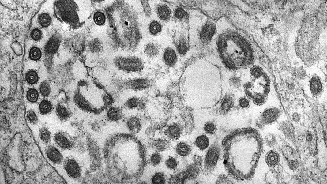 ebola-familie:-toedliches-marburg-virus-in-ghana-entdeckt-−-was-man-dazu-wissen-muss ebola-familie:-toedliches-marburg-virus-in-ghana-entdeckt-−-was-man-dazu-wissen-muss