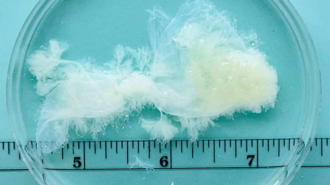 aufklaerung:-kein-miniatur-baby:-so-sehen-embryos-in-den-ersten-wochen-der-schwangerschaft-wirklich-aus aufklaerung:-kein-miniatur-baby:-so-sehen-embryos-in-den-ersten-wochen-der-schwangerschaft-wirklich-aus
