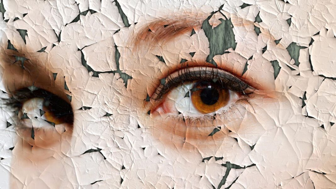 pflegetipps:-trockene-gesichtshaut:-so-behandeln-sie-raue-oder-juckende-partien pflegetipps:-trockene-gesichtshaut:-so-behandeln-sie-raue-oder-juckende-partien